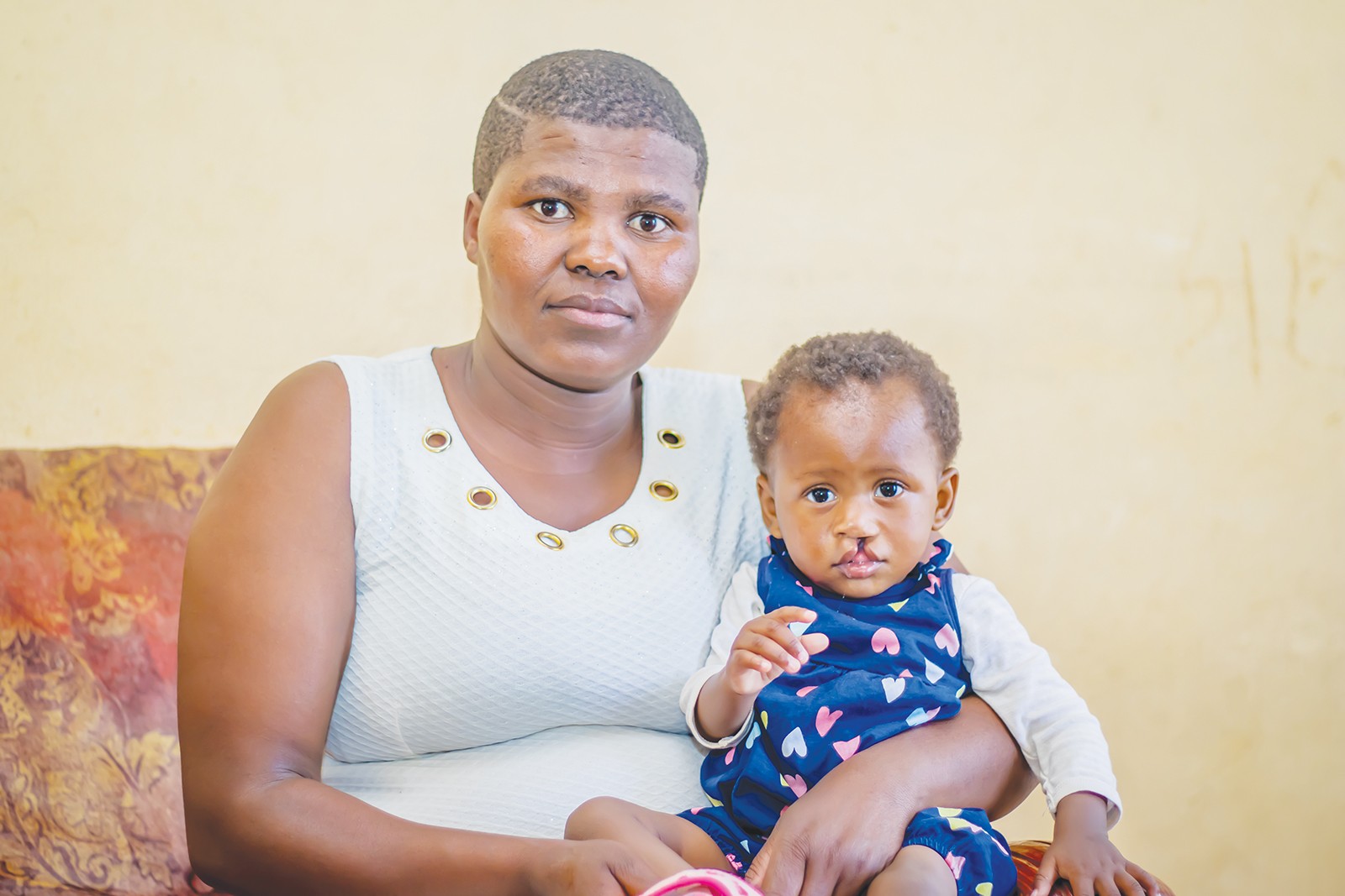 cleft-lip-takes-toll-on-poor-family